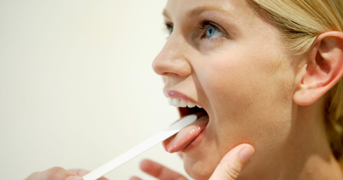 Vitamin B12 deficiency symptoms as unusual sign can…