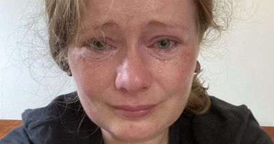 Woman left in 'living hell' and 'pain every day' after routine eye surgery