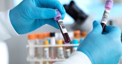 'Blood test boosts chances of cancer detection – and it could save lives'
