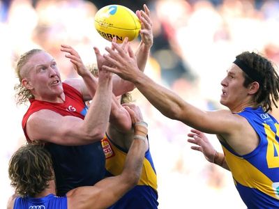 Oliver injury will make us stronger: Melbourne coach