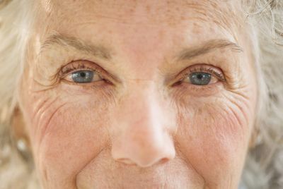 Does Medicare cover cataract surgery? What you need to know