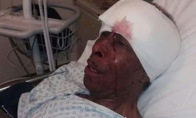 Elderly black man who was punched by police officer wins judicial review