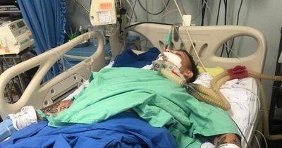 Student fighting for life thousands of miles from home after balcony fall