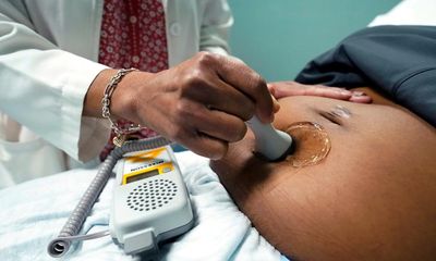 Test approved to detect preeclampsia, leading cause of US maternal deaths
