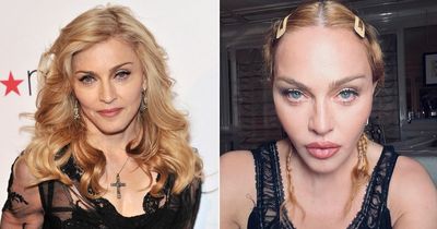 Madonna urged to realise 'surgery won't stop ageing' and told to 'take a break'
