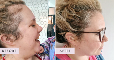 Shoppers swear by ‘amazing’ supplements that transformed hair in just weeks