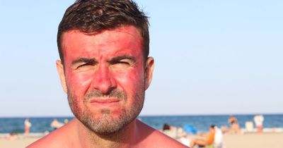 Dublin weather: Top tips on protecting your skin ahead of weekend scorcher