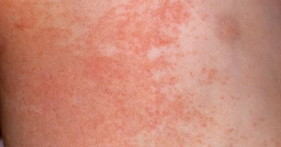 Beauty buffs hail £7 Amazon cream a Summer 'must' for anybody who gets shaving or heat rash