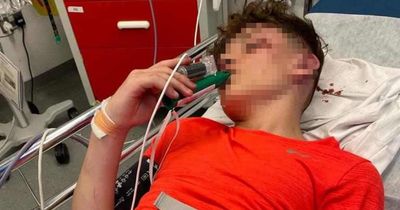 Boy, 13, in ICU after brutal 20-minute assault in Dublin as mum tells how he thought he was going to die