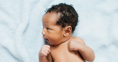 Calls to change newborn health checks amid concerns over focus on babies' skin colour