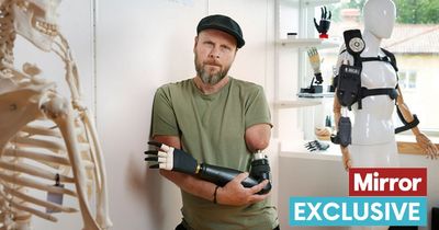 'My arm was chopped off at work - now I've got world's first bionic arm'