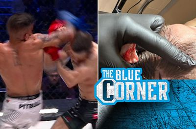 KSW 84 featured two incredibly disgusting head gashes that’ll make you wish you didn’t look