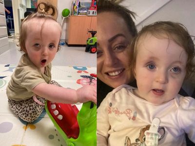 Mother reveals bruise on her toddler’s eye led to cancer diagnosis