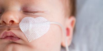 RSV is everywhere right now. What parents need to know about respiratory syncytial virus