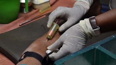 Acute shortage of HIV testing kits in Karnataka hits patients hard
