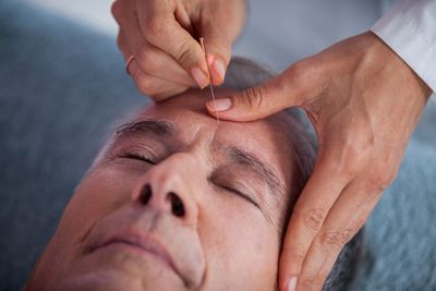 Does Medicare cover acupuncture?