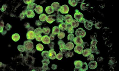 Georgia resident dies from rare ‘brain-eating amoeba’