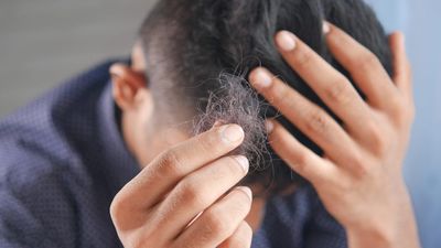 Over Half Of Men With Hair Loss Are Self-conscious About Socializing