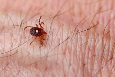 A mysterious tick-related meat allergy