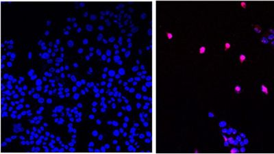 Scientists Develop Molecule That Kills Tumors Without Affecting Other Cells