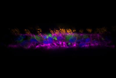 Lung-like organoids unlock lung disease
