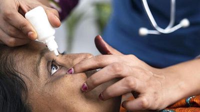Telangana sees rise in conjunctivitis cases; students face brunt of outbreak