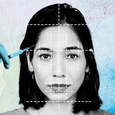 Facial Balancing Is a Holistic Approach to Filler—And the Results Are Wild