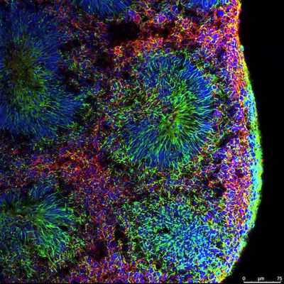 Tiny Brains In a Dish Could Finally Uncover the Long-standing Mysteries of Psychedelics