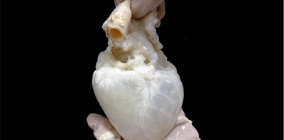 Lab-grown ‘ghost hearts' work to solve organ transplant shortage by combining a cleaned-out pig heart with a patient’s own stem cells