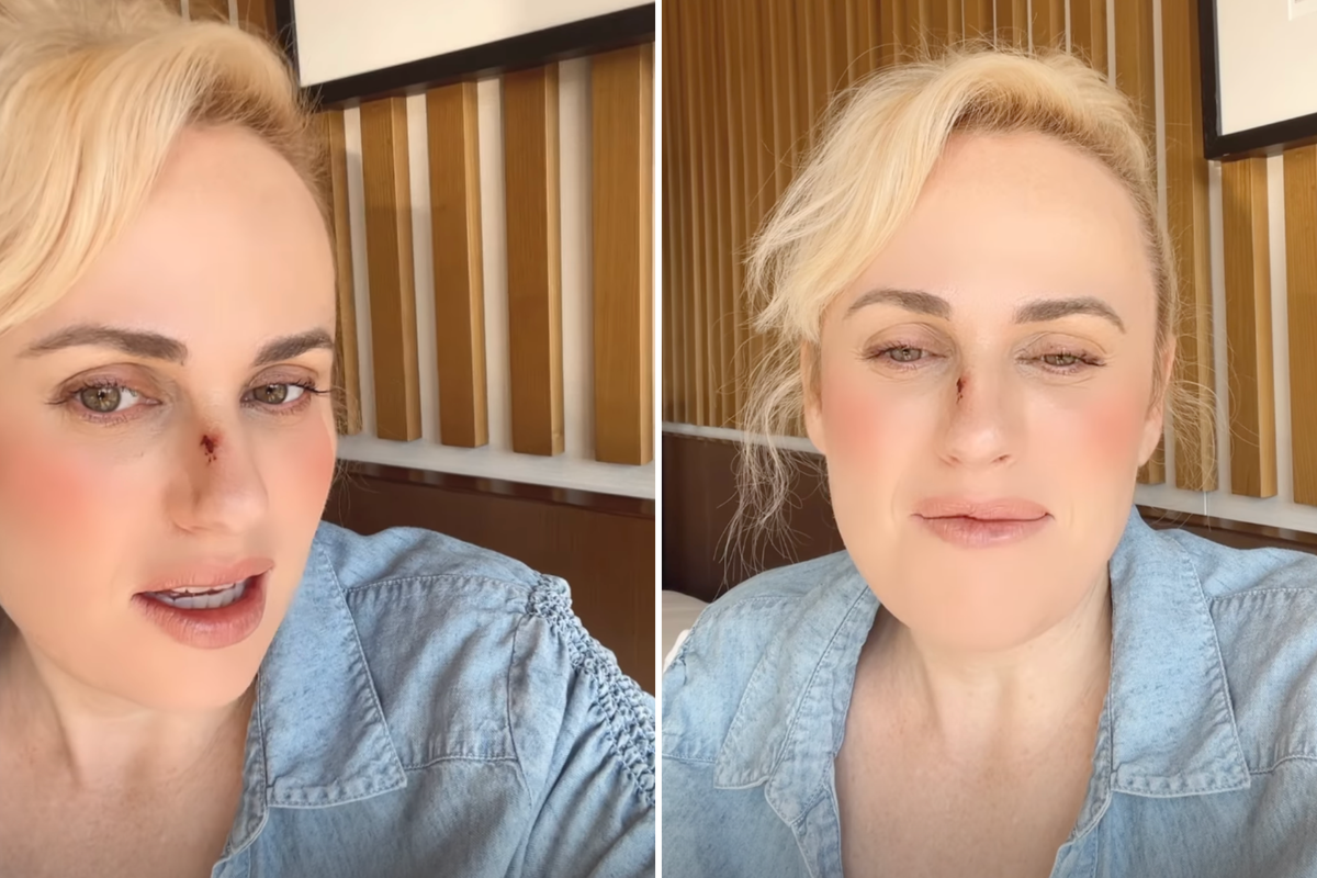Rebel Wilson details on-set ‘stunt accident’ that left…