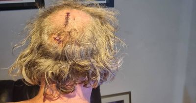'I was fighting them in my underpants'; housing tenant blames attack on poor security