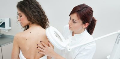 Skin cancer screening guidelines can seem confusing – three skin cancer researchers explain when to consider getting checked