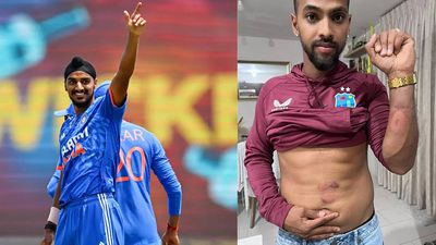 Bruised and battered! See what Arshdeep Singh did to Nicholas Pooran