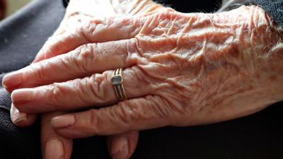 Scottish research firm to develop early test for Alzheimer's disease