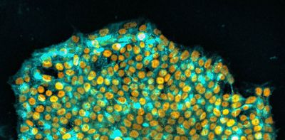 A 'memory wipe' for stem cells may be the key to better therapies