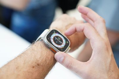 Apple Watch X: 7 Features the 10th Anniversary Redesign Should Have
