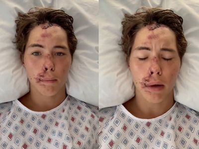 Influencer Caleb Coffee hospitalised after falling off cliff in Hawaii: ‘It’s a miracle that I’m alive today’