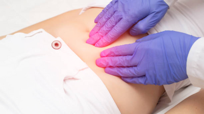 Woman's ordeal with 35 pound cyst; "people thought I was pregnant"