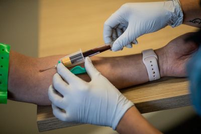 Blood test ‘may predict heart disease risk for people with type 2 diabetes’