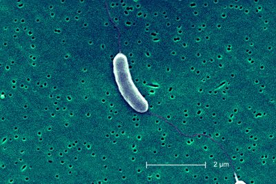 Flesh-eating bacteria spreads across US