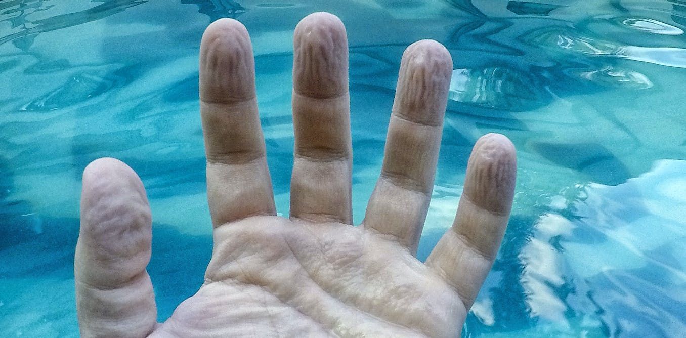 why-do-fingers-get-wrinkly-after-a-long-bath-or-swim