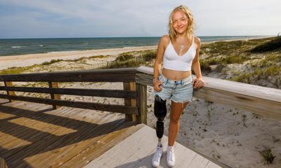 At 17, a shark attack cost me my leg. A year later, I’m back in the water where I almost died