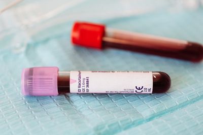 New Blood Test Could Diagnose Parkinson’s Disease Sooner
