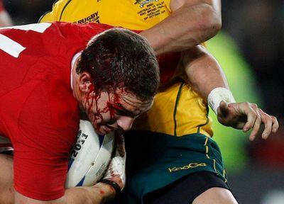NFL-style lawsuit and brain-injury concerns hang over Rugby World Cup