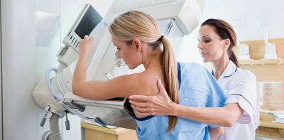 Cancer is rising in under-50s – but the causes are a mystery