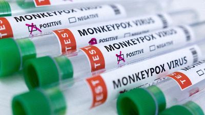 Monkeypox surveillance helps identify variant of virus causing chickenpox