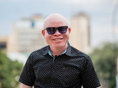 He's a singer, a cop and the inspiration for a Netflix film about albinism in Africa