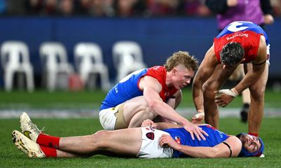Concussion an issue AFL can’t afford to smother