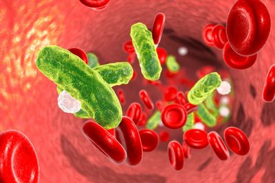 World Sepsis Day: What is the condition and its symptoms?
