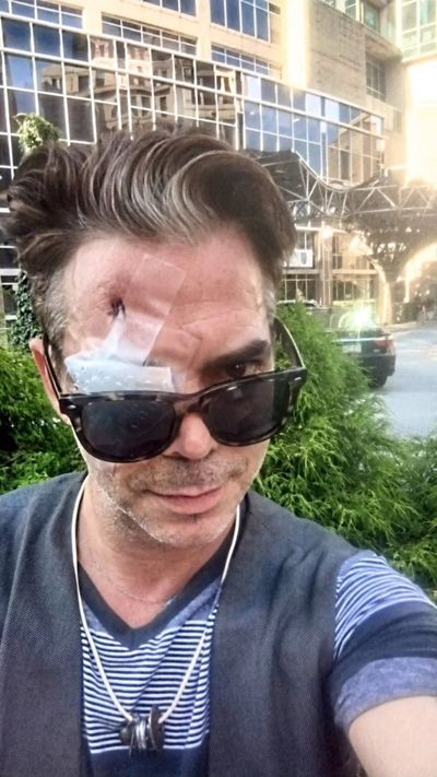 GoFundMe for actor blinded in attack over Covid mask tops $15,000